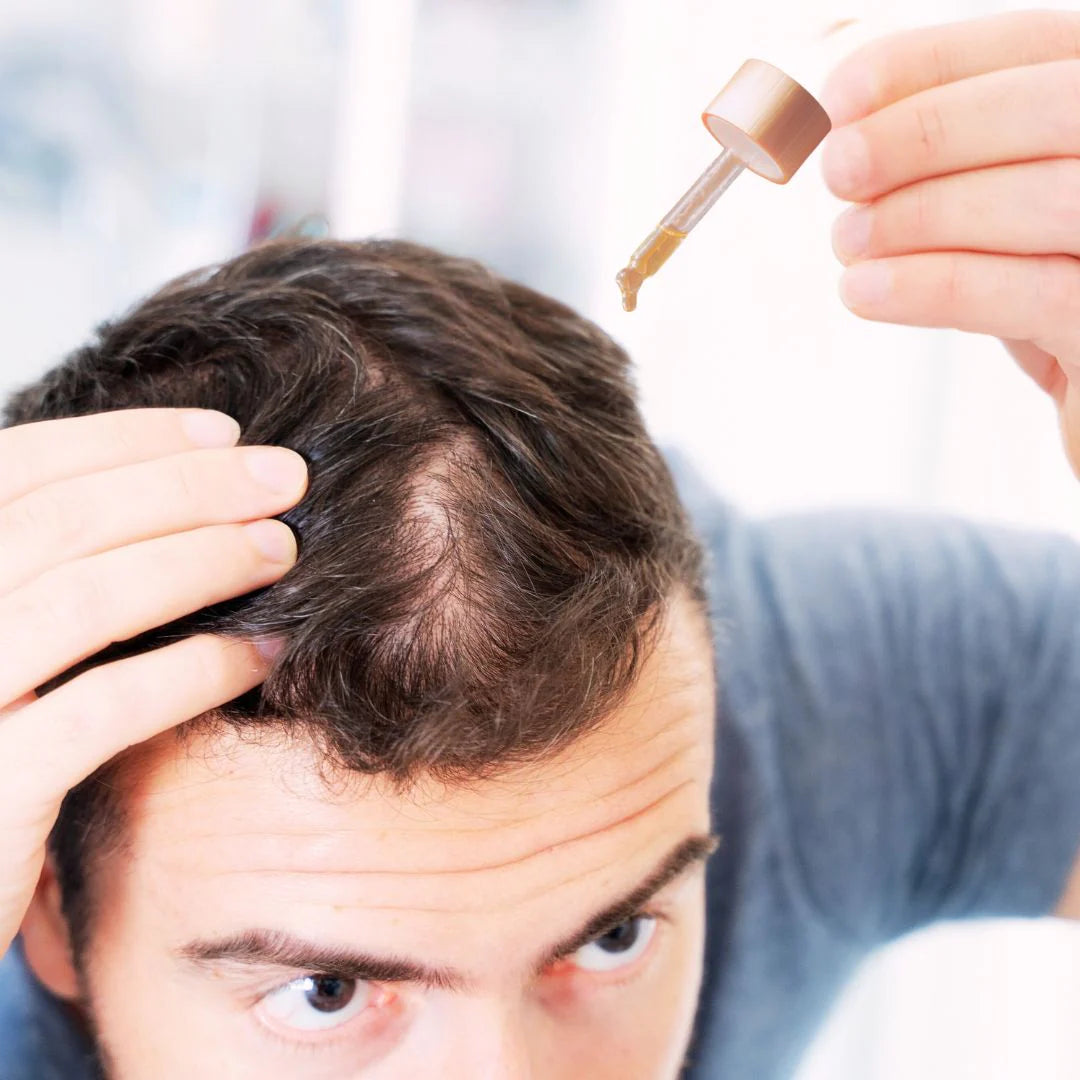1. Apply to Scalp