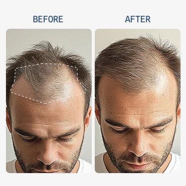 Revola Hair Regrowth Serum 2.0