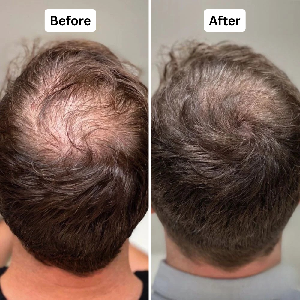 Feature product image